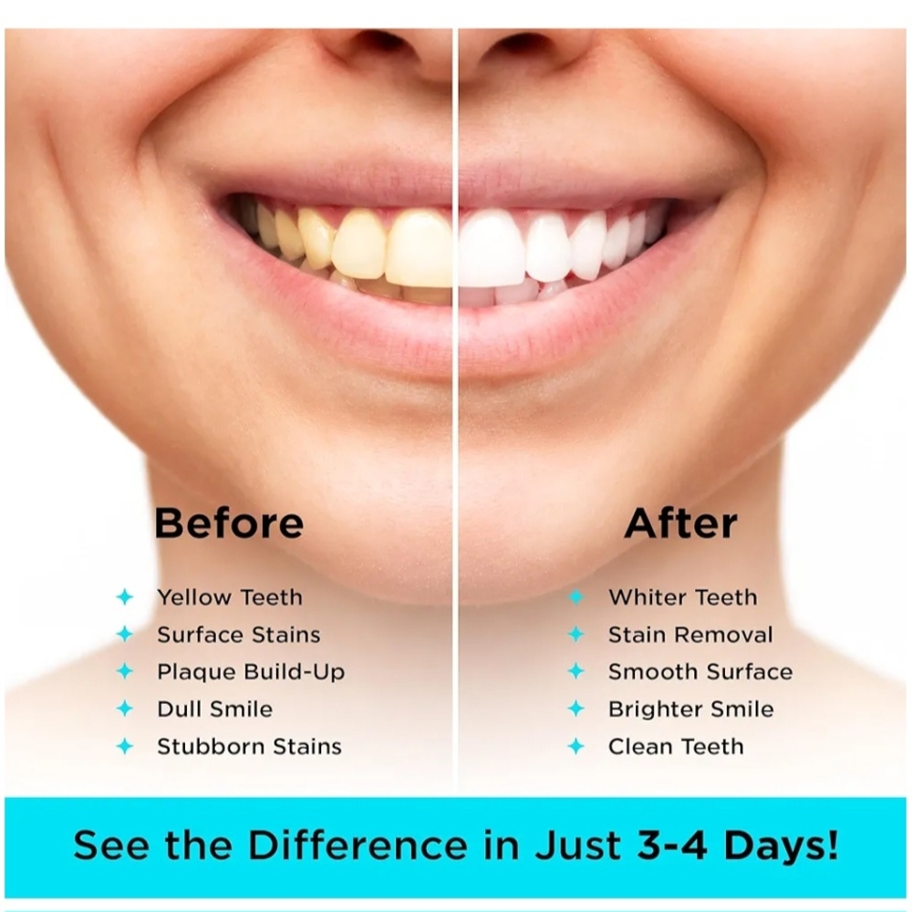 Activated Charcoal Teeth Whitening Powder, Sealed Pkg